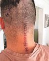 Dad transforms his life after brain surgery5