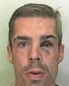 Violent thug bit fellow bus passenger's face7