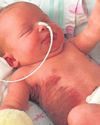 Mum's heartbreak over cancer news11
