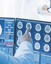 ‘Dangerous’ radiology shortages in rural areas ‘Dangerous’ radiology shortages in rural areas11