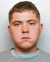 Thug bit off part of a man's ear before laughing about it The Sentinel