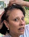 Mel: I'm losing my hair Daily Star Sunday