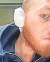 'I had my ear bitten off after trying to stop a fight... and the thug who did it only got a fine'3