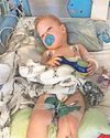 Brave Finley diagnosed with rare cancer0