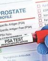 As Jeremy Clarkson tells of prostate cancer diagnosis, how can men over 60 spot the symptoms? As Jeremy Clarkson tells of prostate cancer diagnosis, how can men over 60 spot the symptoms?24