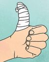 What help is at hand for my sprained thumb?25