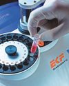 EKF Diagnostics in Beep Insights deal24
