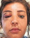 Student left in a coma after horror scooter crash on gap year trip to India Student left in a coma after horror scooter crash on gap year trip to India4
