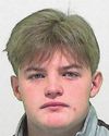 Teenager's eye injured during night out attack Teenager's eye injured during night out attack1
