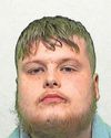 Boyfriend told woman to lie after he stabbed her in foot10