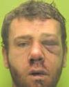 Thug stabbed man in back with scissors and bit a police officer Thug stabbed man in back with scissors and bit a police officer8