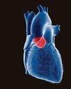 Women less likely to get heart disease treatment12