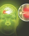 PROGRESS ON RUGBY HEAD INJURIES 'PRETTY SLOW'4