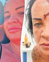 'The police said I was six minutes away from losing my life'3
