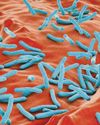 HSE warn of tuberculosis cough risk HSE warn of tuberculosis cough risk