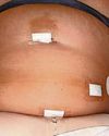 'Weight-loss jabs made my tongue turn black'35