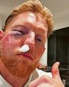 STOKES: I'M JUST LUCKY TO BE ALIVE78