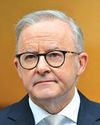 Australia Albanese leads in early election polls Australia Albanese leads in early election polls16