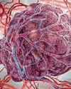 Bleak rise in illness linked to boozing and smoking1