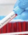 Scots waiting on access to revolutionary cancer test28