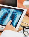 LACK OF STAFF 'TICKING TIME BOMB' IN CANCER CARE0