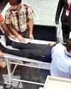 JAWS BROKEN AND SPINE FRACTURED3