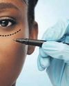 The truth about cosmetic surgery scars9