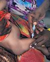 Vaccination projects to be hit as Washington cuts USAID grants Vaccination projects to be hit as Washington cuts USAID grants37
