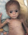 'Absolute cruelty' The baby girl who has come to symbolise Gaza's pain49