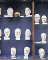 Taken without consent The complex history of Edinburgh's skull room22