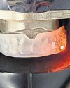 Mouthguards for concussion to be used at Women's World Cup63