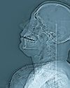 'Trying to kill them': X-rays reveal severity of crackdown 'Trying to kill them': X-rays reveal severity of crackdown7