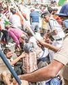 RG Kar victim's mother injured in police lathicharge13