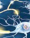 ESTROGEN COULD AID IN THERAPIES FOR PROGRESSIVE MULTIPLE SCLEROSIS61