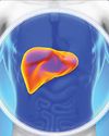 Lifestyle and Fatty Liver: A ticking health bomb