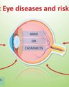 Boost Your Eye Health With Nutraceuticals: Preventing Cataracts And Diabetic Complications