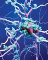 Sleep patterns may reveal comatose patients with hidden consciousness: Study20