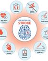 Protecting Her Health: Understanding Stroke Risks and Rehabilitation Insights for Women Protecting Her Health: Understanding Stroke Risks and Rehabilitation Insights for Women