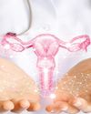 Fibroid cases rising in young women due to obesity and modern lifestyle78