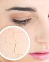 Balancing Doshas for Healthy Skin — Shahnaz Husain's Insights75
