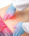 'I thought it was just gas pain': The hidden signs of a hernia you shouldn't ignore75