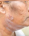 Booth Level Officer suffers injuries after Kottayam local sets dog on her Booth Level Officer suffers injuries after Kottayam local sets dog on her16