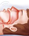 Sleep Apnea: Recognizing the silence, and finding rest Sleep Apnea: Recognizing the silence, and finding rest39