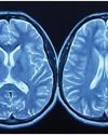 MRI scans show exercise can make the brain look younger: Study138