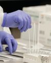 COMMON DIABETES TEST MAY MISDIAGNOSE INDIANS76