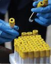YOUR AGE MAY INFLUENCE ANTIBODY PRODUCTION IN RESPONSE TO A VIRUS YOUR AGE MAY INFLUENCE ANTIBODY PRODUCTION IN RESPONSE TO A VIRUS60