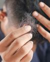 THE RISE OF HAIR ANXIETY AMONG YOUNG PROFESSIONALS THE RISE OF HAIR ANXIETY AMONG YOUNG PROFESSIONALS67