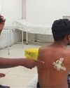 किशोर पर बर्फ तोड़ने वाले सुए से 6 वार16