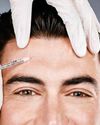 Why men turning to Botox.no longer raises eyebrows