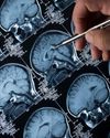 A simple blood test could predict Alzheimer's decline The Independent